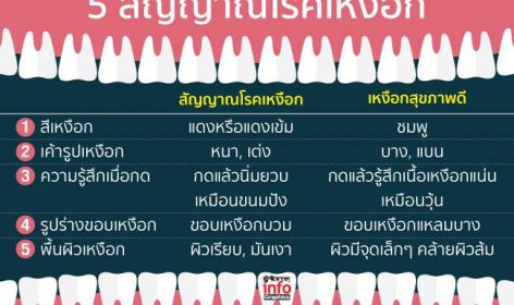 รู้ทัน 5 สัญญาณโรคเหงือก